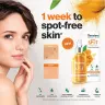 Himalaya Dark Spot Clearing Curcuma Face Serum (30 ml, Kurkuma)
